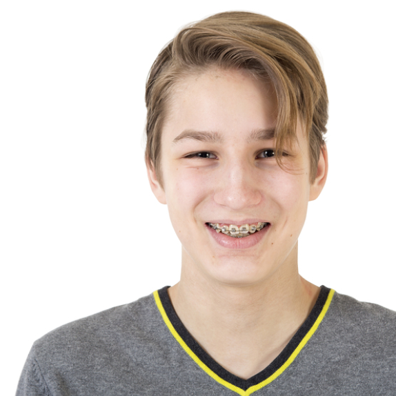 Teenager with Traditional Braces