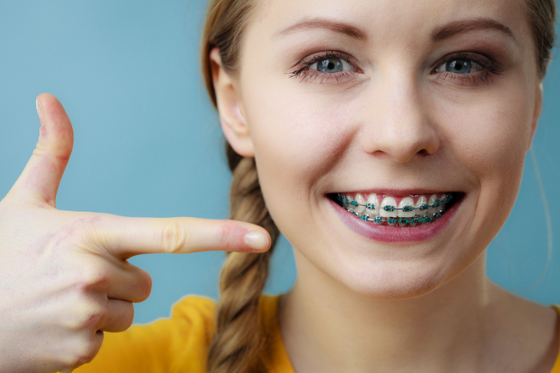 Traditional Braces in Southlake, TX
